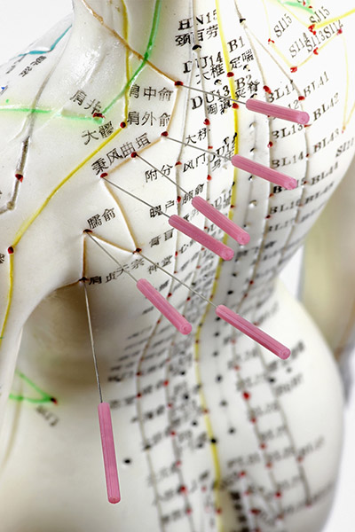 Dr George Mandel Santa Fe Acupuncturist